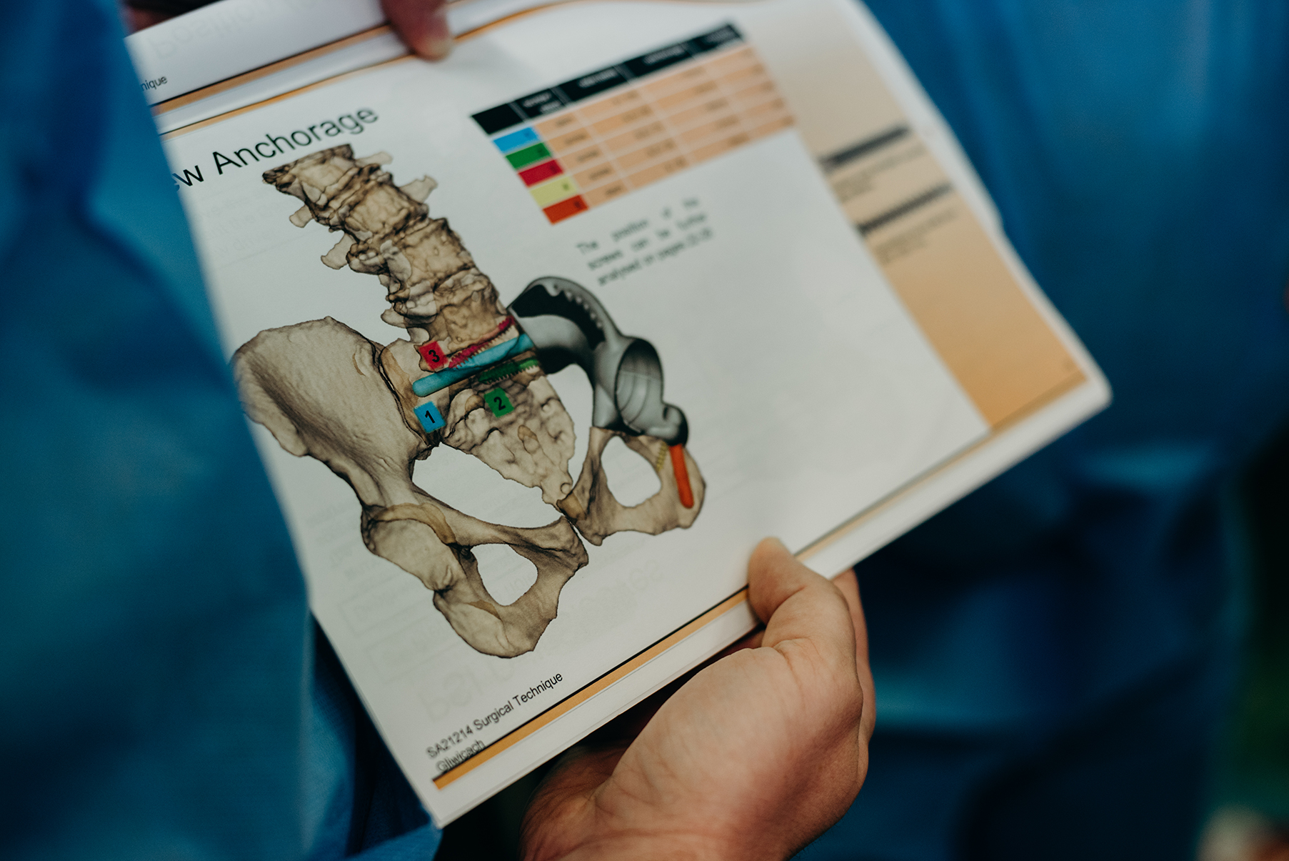 projekt implantu kości miednicy w 3D